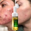 Mousse nettoyante au thé vert avec brosse exfoliante intégrée – avant après